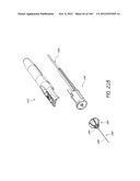 ANESTHETIC INJECTION SYSTEM diagram and image