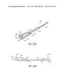 ANESTHETIC INJECTION SYSTEM diagram and image