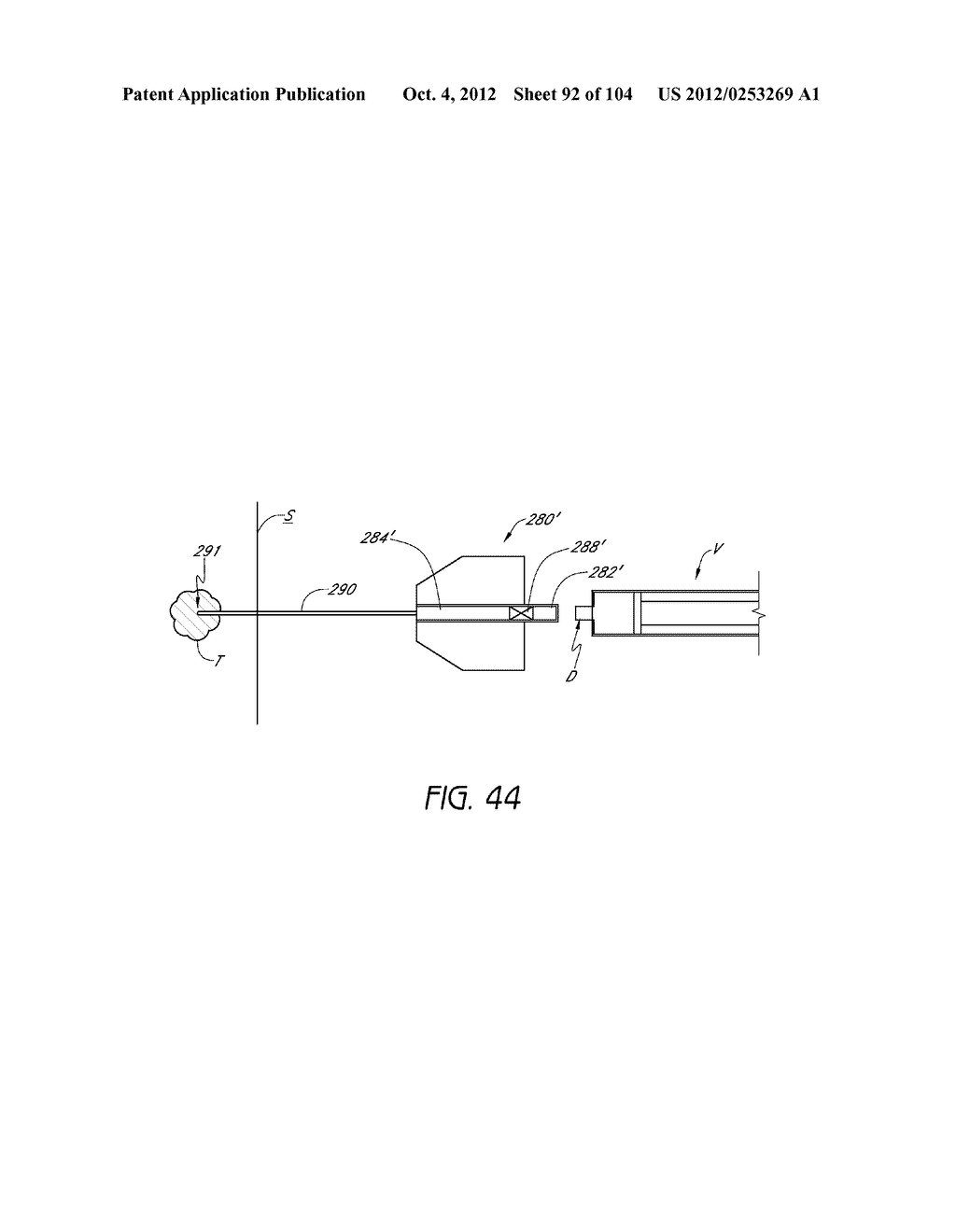 ANESTHETIC INJECTION SYSTEM - diagram, schematic, and image 93