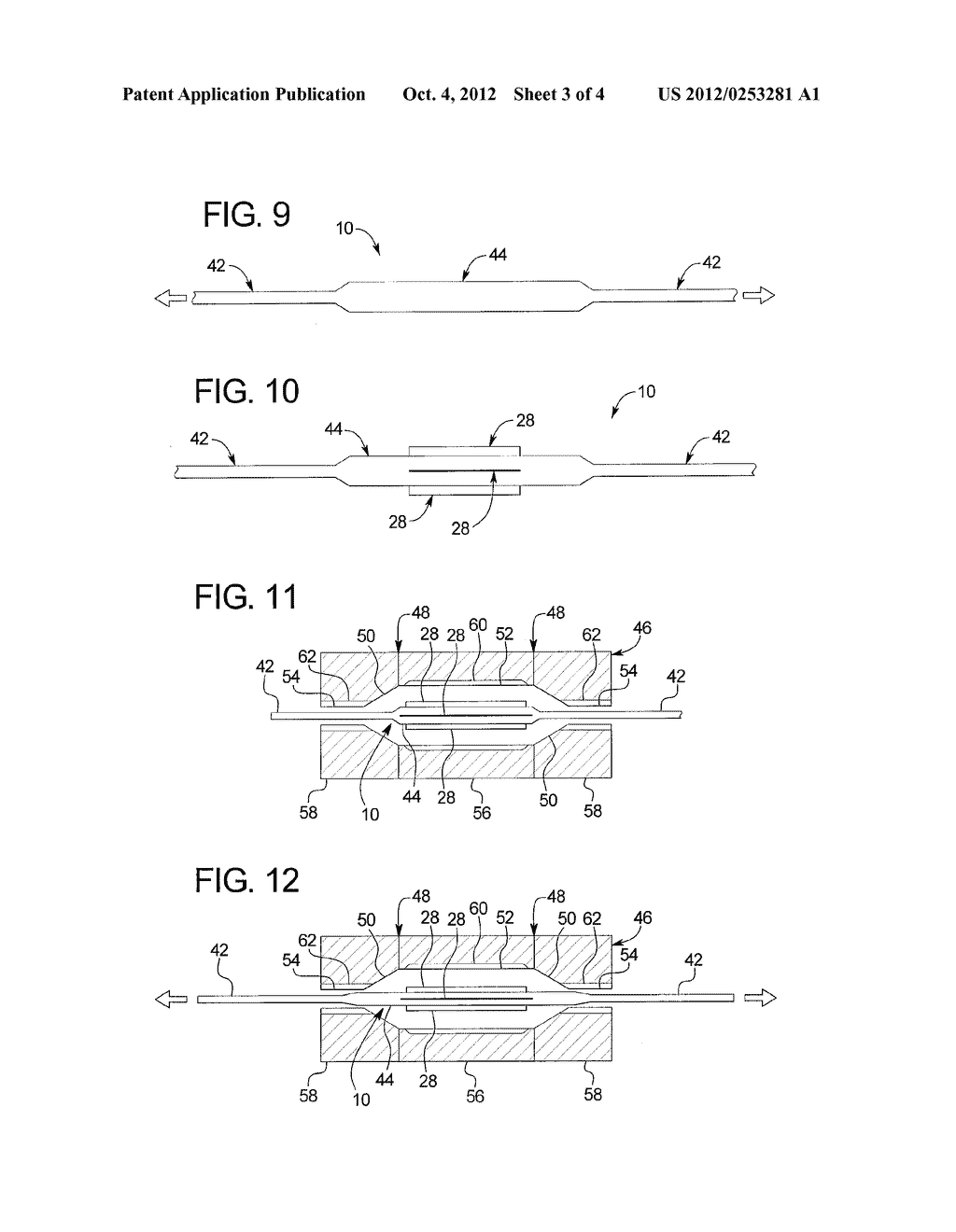 BALLOON WITH INTEGRAL RETENTION OF A DILATION ELEMENT - diagram, schematic, and image 04