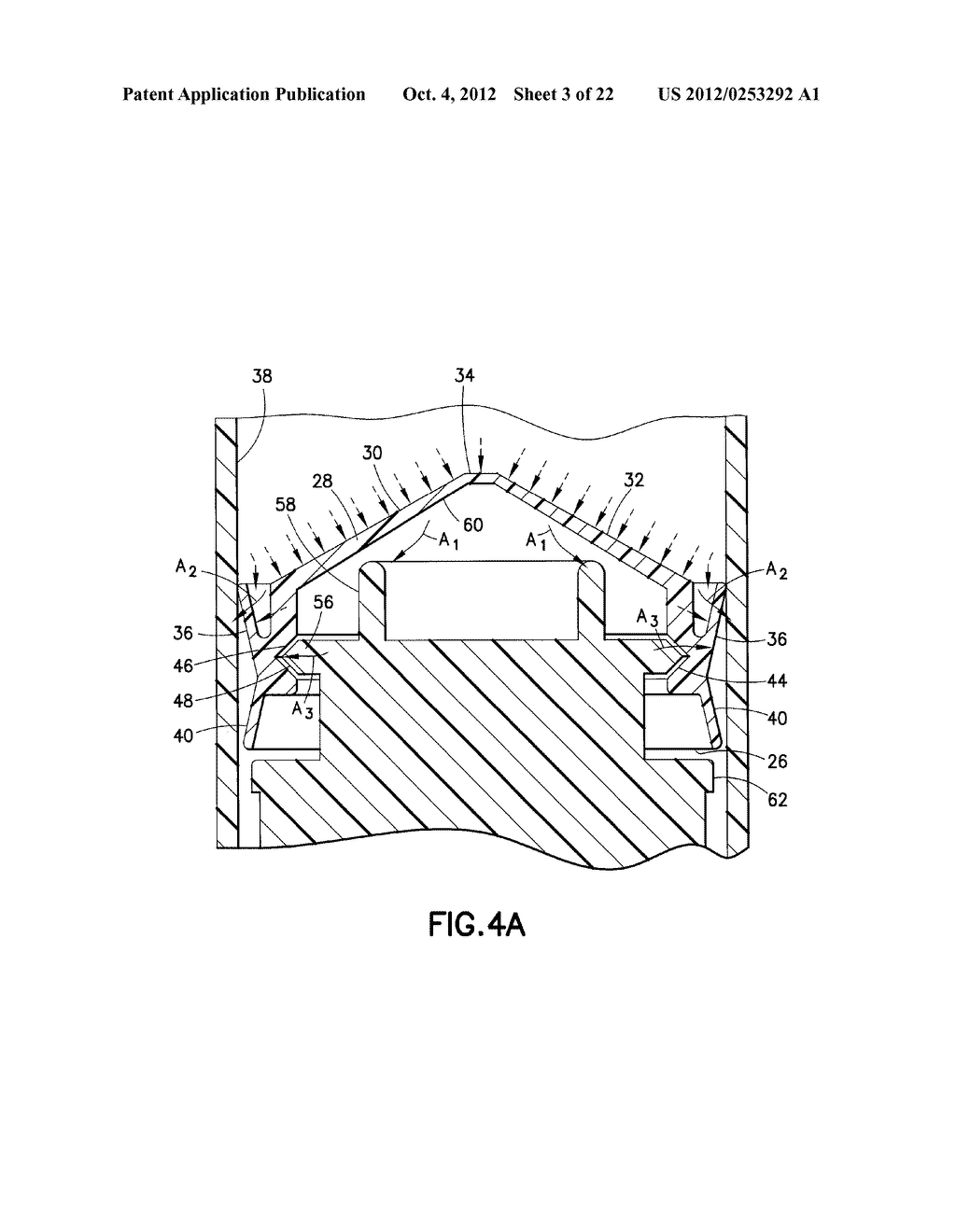 Plastic Stopper - diagram, schematic, and image 04