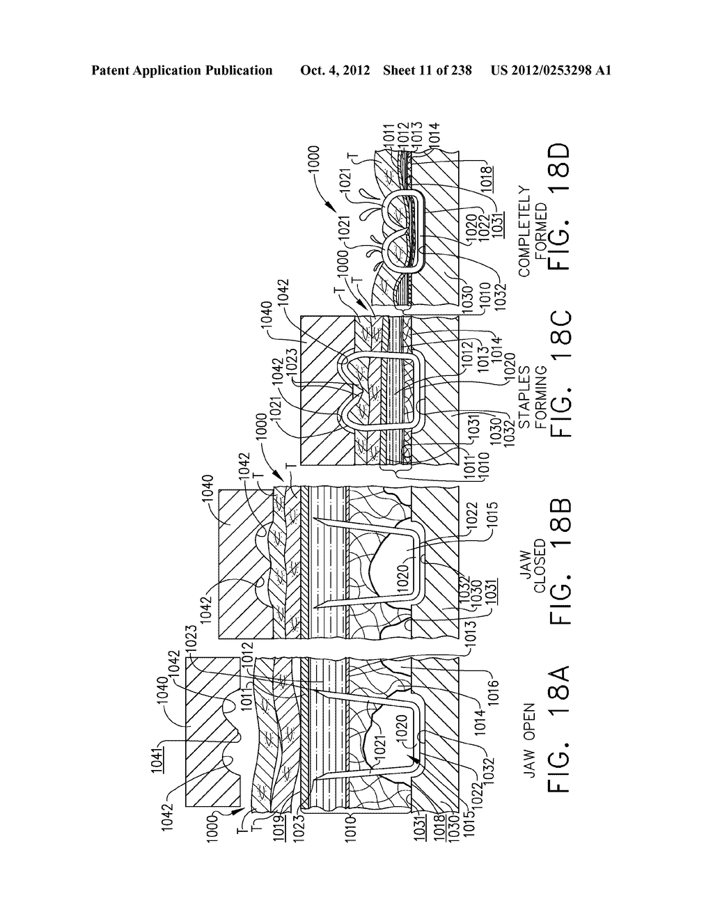 LAYERED TISSUE THICKNESS COMPENSATOR - diagram, schematic, and image 12