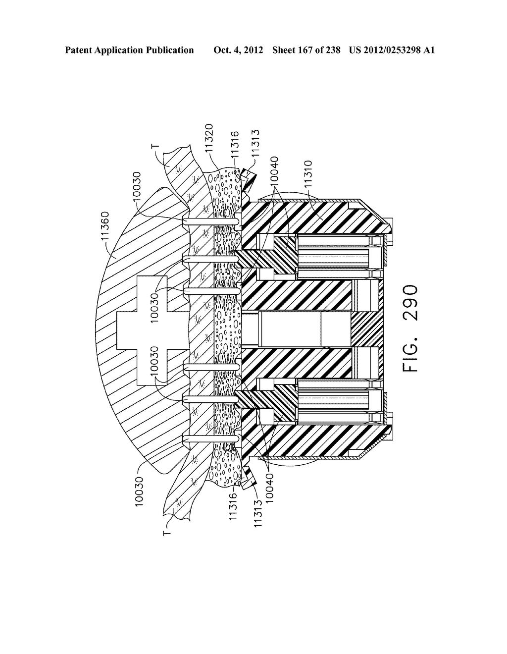 LAYERED TISSUE THICKNESS COMPENSATOR - diagram, schematic, and image 168