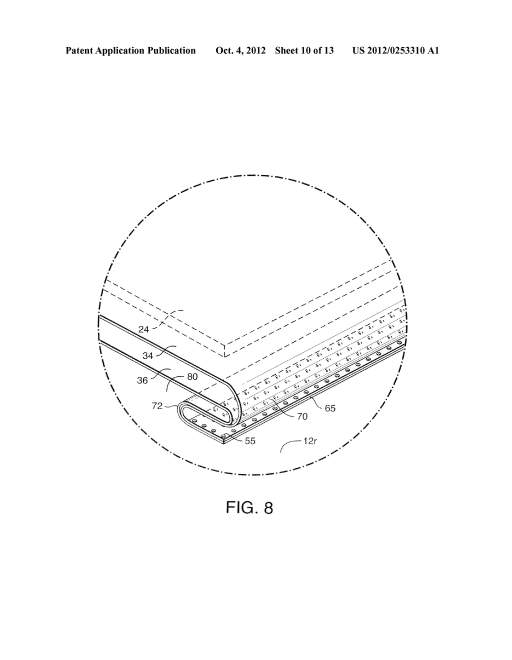 PROCESS FOR MAKING ELASTOMERIC ABSORBENT GARMENTS TO REDUCE ABSORBENT     BUNCHING, AND GARMENT MADE THEREBY - diagram, schematic, and image 11