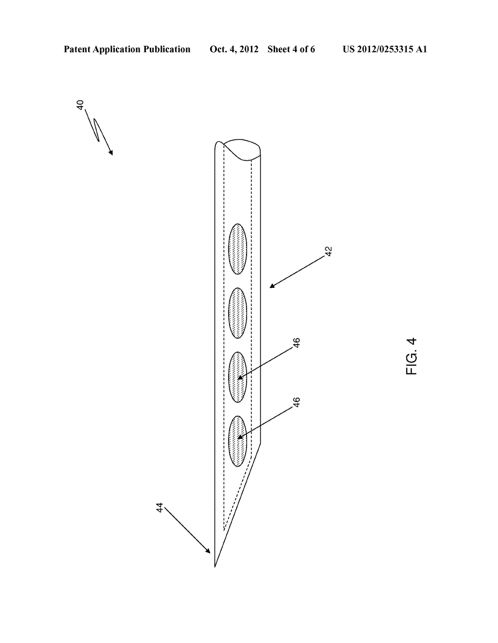 INJECTION NEEDLE FOR FRACTURES - diagram, schematic, and image 05