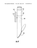 PERCUTANEOUS BIOLOGIC DELIVERY SYSTEM diagram and image