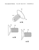 PERCUTANEOUS BIOLOGIC DELIVERY SYSTEM diagram and image