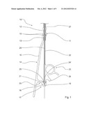 GUIDE WIRE FIXATION diagram and image