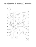 GUIDE WIRE FIXATION diagram and image