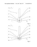 GUIDE WIRE FIXATION diagram and image