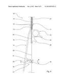 GUIDE WIRE FIXATION diagram and image