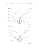 GUIDE WIRE FIXATION diagram and image