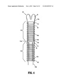 Dual Cable Triangulation Mechanism diagram and image