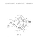 SURGERY METHODS USING A ROBOTIC INSTRUMENT SYSTEM diagram and image