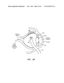 SURGERY METHODS USING A ROBOTIC INSTRUMENT SYSTEM diagram and image