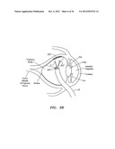 SURGERY METHODS USING A ROBOTIC INSTRUMENT SYSTEM diagram and image