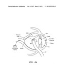 SURGERY METHODS USING A ROBOTIC INSTRUMENT SYSTEM diagram and image