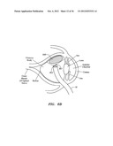 SURGERY METHODS USING A ROBOTIC INSTRUMENT SYSTEM diagram and image