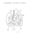 SURGERY METHODS USING A ROBOTIC INSTRUMENT SYSTEM diagram and image