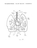 SURGERY METHODS USING A ROBOTIC INSTRUMENT SYSTEM diagram and image