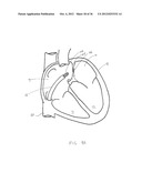 SURGERY METHODS USING A ROBOTIC INSTRUMENT SYSTEM diagram and image