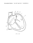 SURGERY METHODS USING A ROBOTIC INSTRUMENT SYSTEM diagram and image