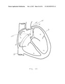 SURGERY METHODS USING A ROBOTIC INSTRUMENT SYSTEM diagram and image