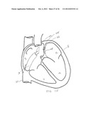 SURGERY METHODS USING A ROBOTIC INSTRUMENT SYSTEM diagram and image