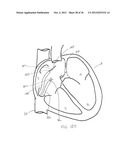 SURGERY METHODS USING A ROBOTIC INSTRUMENT SYSTEM diagram and image