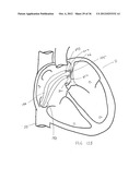 SURGERY METHODS USING A ROBOTIC INSTRUMENT SYSTEM diagram and image