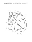 SURGERY METHODS USING A ROBOTIC INSTRUMENT SYSTEM diagram and image