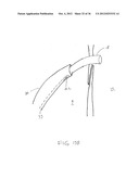 SURGERY METHODS USING A ROBOTIC INSTRUMENT SYSTEM diagram and image