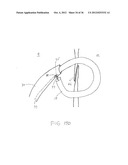 SURGERY METHODS USING A ROBOTIC INSTRUMENT SYSTEM diagram and image