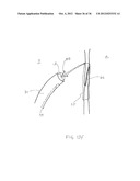 SURGERY METHODS USING A ROBOTIC INSTRUMENT SYSTEM diagram and image