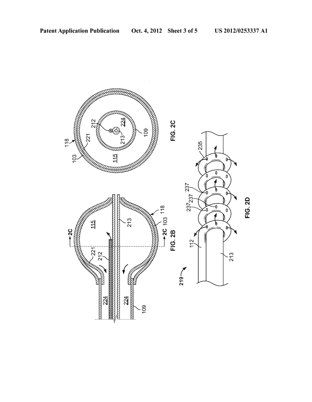 REGULATING INTERNAL PRESSURE OF A CRYOTHERAPY BALLOON CATHETER - diagram, schematic, and image 04