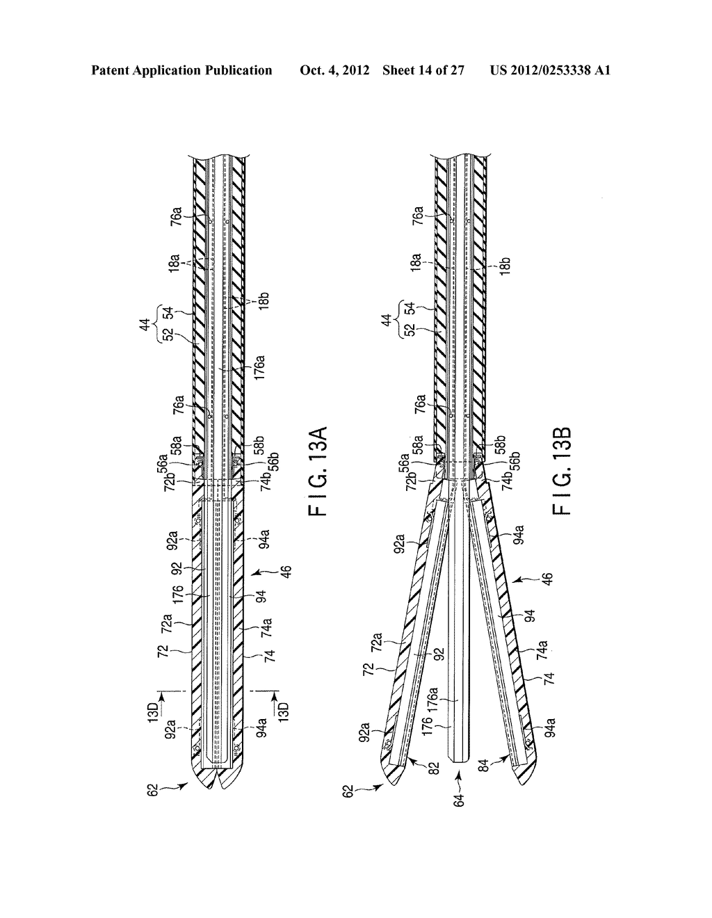 MEDICAL TREATMENT APPARATUS, TREATMENT INSTRUMENT AND TREATMENT METHOD FOR     LIVING TISSUE USING ENERGY - diagram, schematic, and image 15