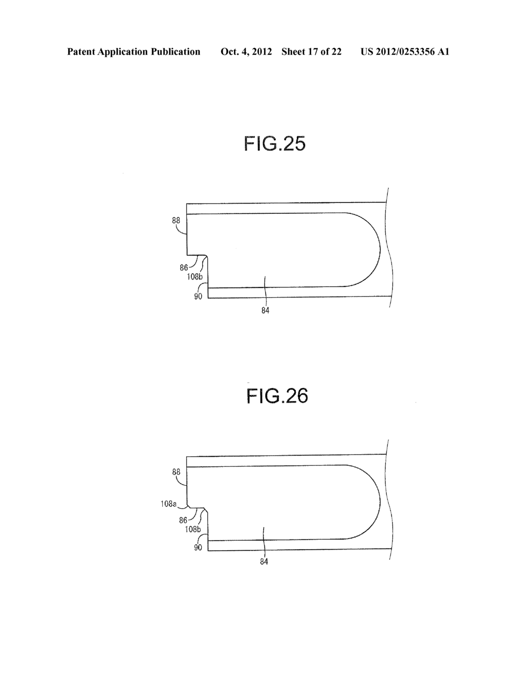 INTRAOCULAR LENS INSERTION DEVICE - diagram, schematic, and image 18