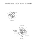 FRACTURING CALCIFICATIONS IN HEART VALVES diagram and image