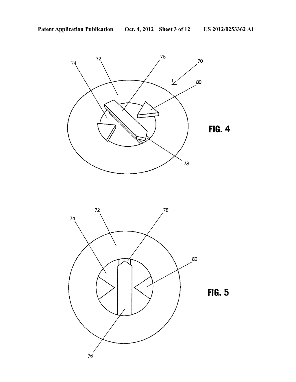 DEVICES AND METHODS FOR SECURING TISSUE - diagram, schematic, and image 04