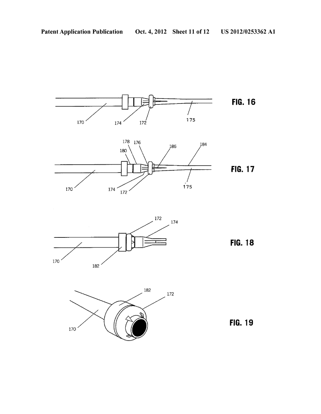 DEVICES AND METHODS FOR SECURING TISSUE - diagram, schematic, and image 12