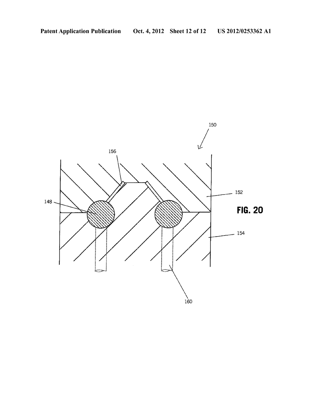 DEVICES AND METHODS FOR SECURING TISSUE - diagram, schematic, and image 13