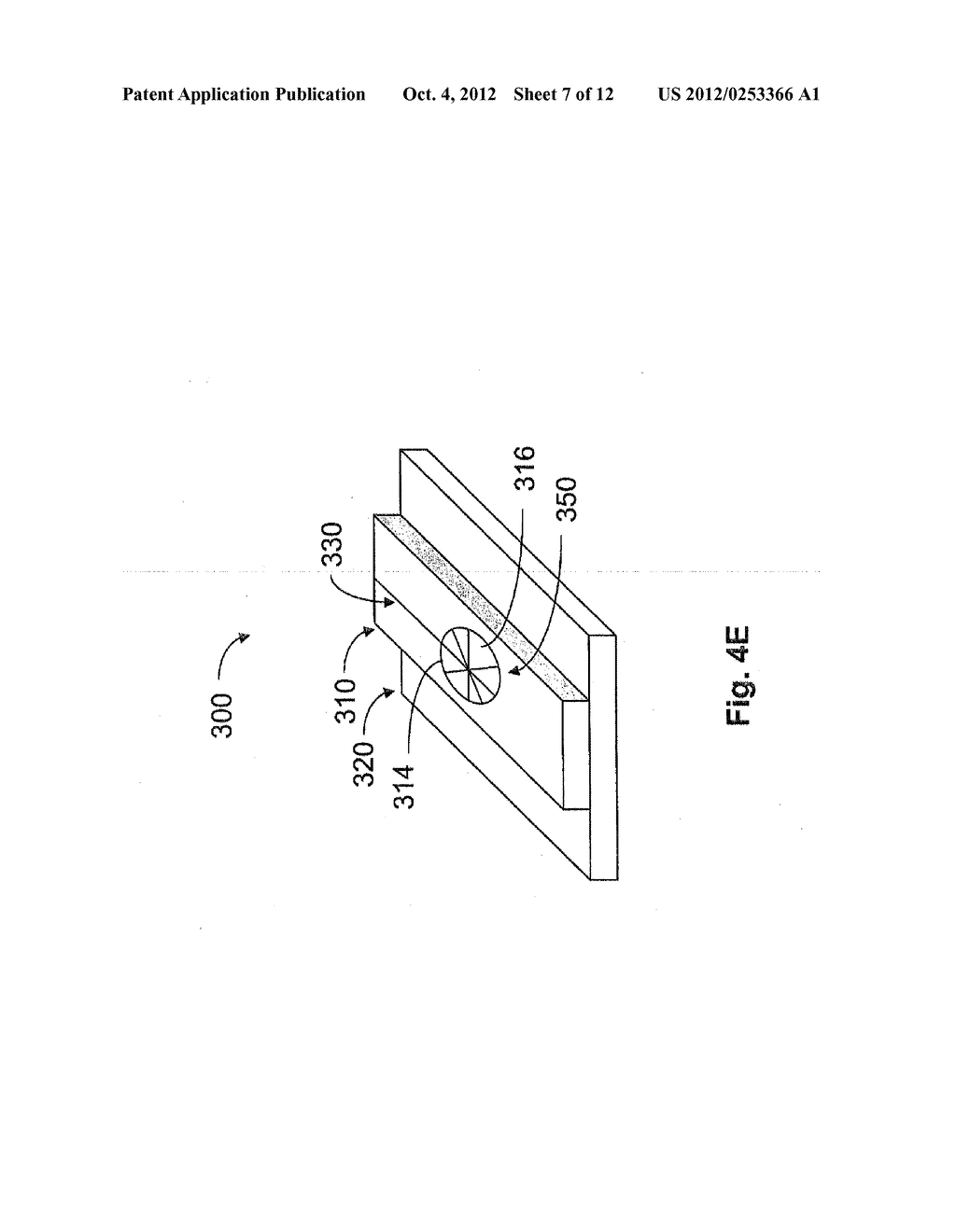 FABRIC PROSTHESIS FOR REPAIRING A TISSUE WALL DEFECT IN PROXIMITY OF A     TUBE-LIKE STRUCTURE - diagram, schematic, and image 08