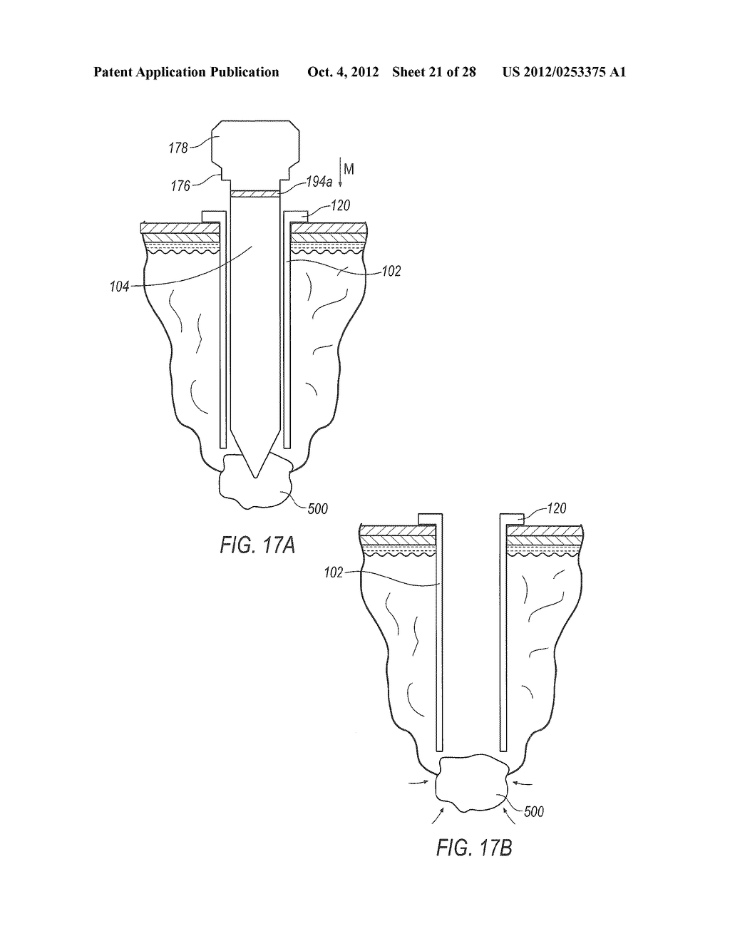 SURGICAL ACCESS ASSEMBLY AND METHOD OF USING SAME - diagram, schematic, and image 22