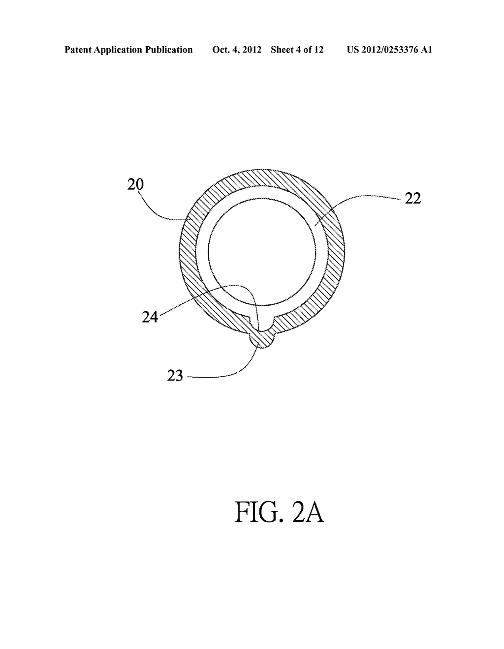 NATURAL ORIFICE TRANSLUMENAL ENDOSCOPIC SURGERY (NOTES) DEVICE - diagram, schematic, and image 05