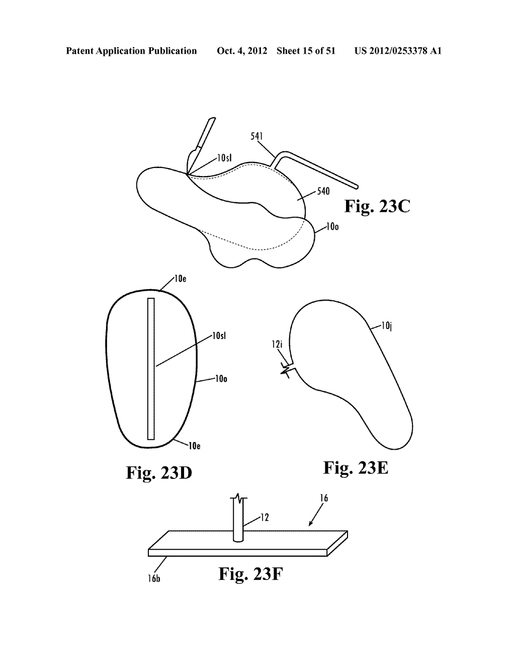 Devices and Methods for Treatment of Obesity - diagram, schematic, and image 16