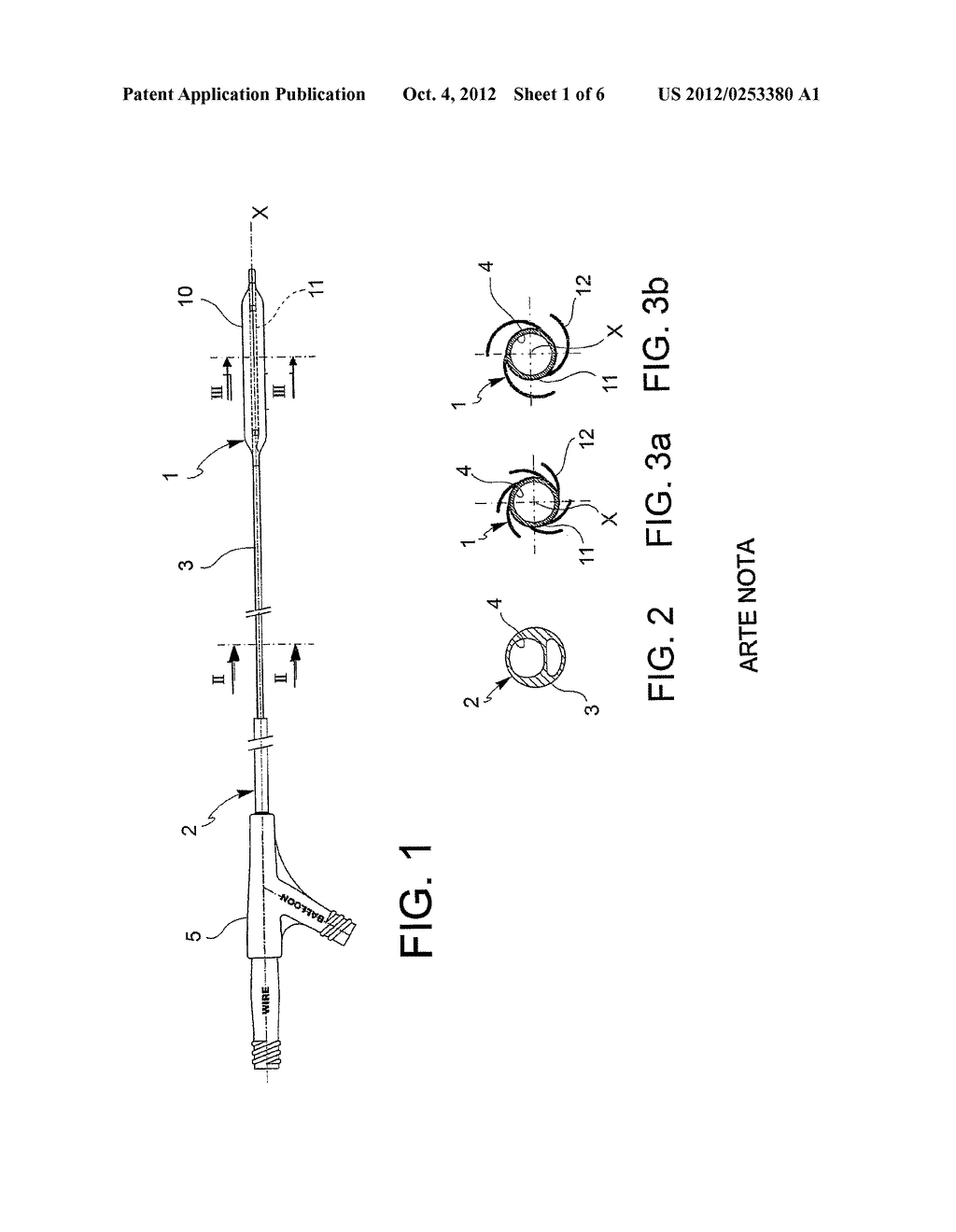 Balloon for the treatment of stenosis and method for manufacturing the     balloon - diagram, schematic, and image 02