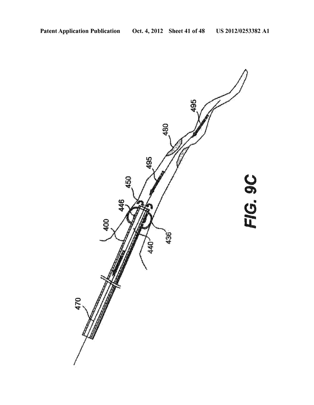 EMBOLI PROTECTION DEVICES AND RELATED METHODS OF USE - diagram, schematic, and image 42