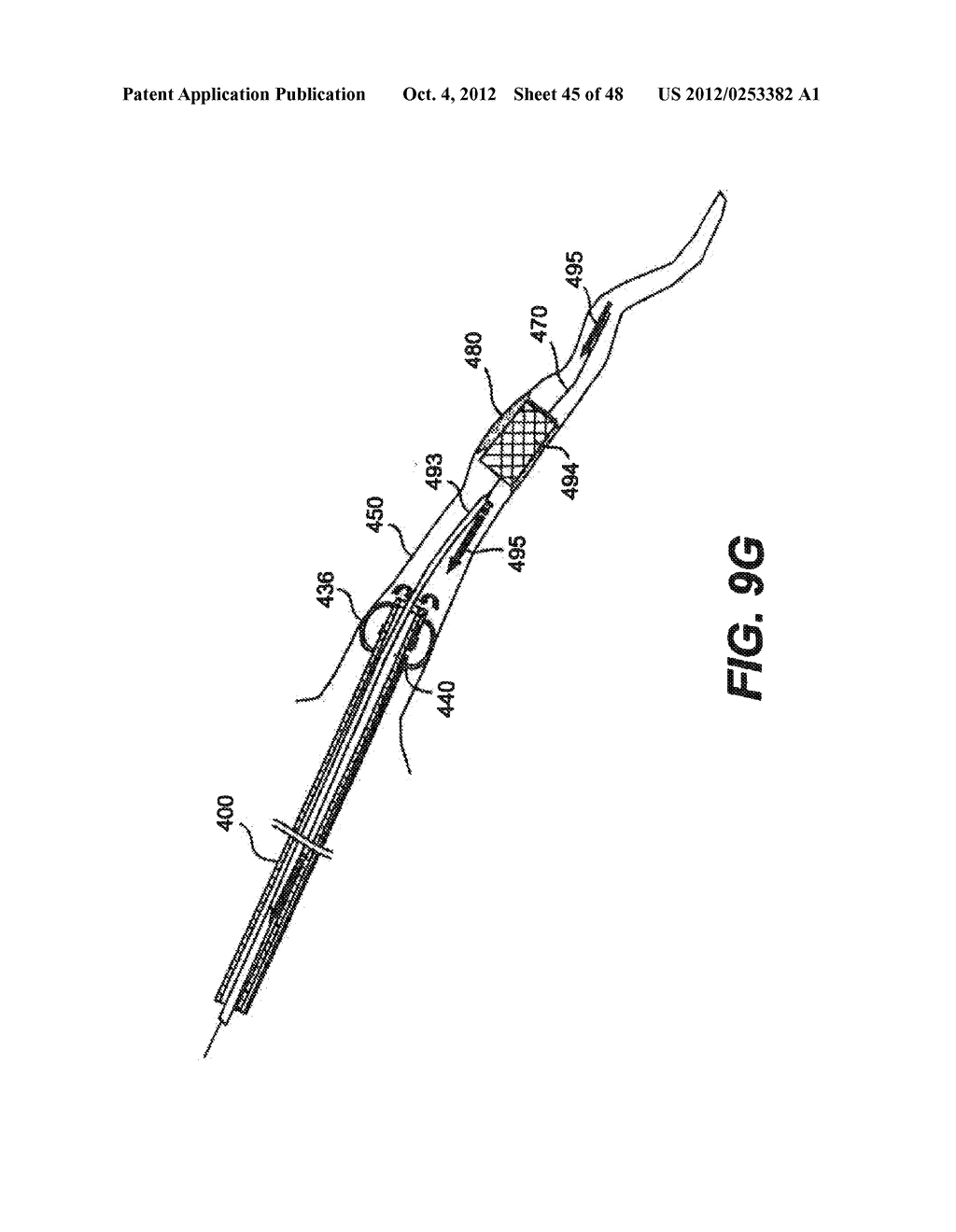 EMBOLI PROTECTION DEVICES AND RELATED METHODS OF USE - diagram, schematic, and image 46