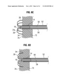 APICAL PUNCTURE ACCESS AND CLOSURE SYSTEM diagram and image