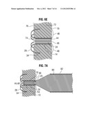 APICAL PUNCTURE ACCESS AND CLOSURE SYSTEM diagram and image